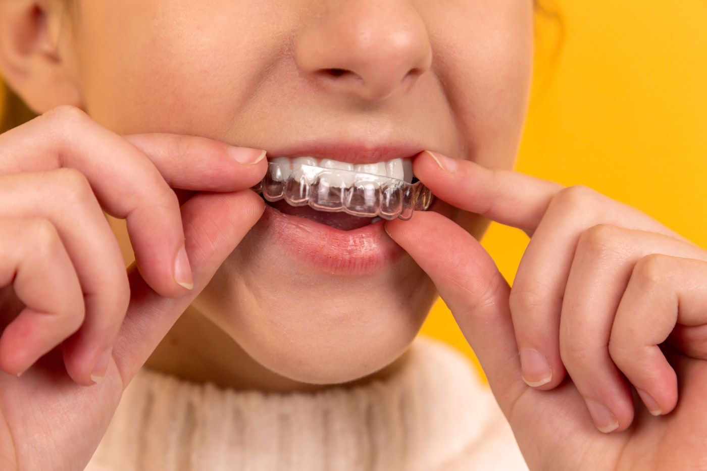 Close view of a clear dental aligner being fitted